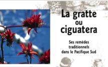 La gratte ou la ciguatera La gratte ou la ciguatera